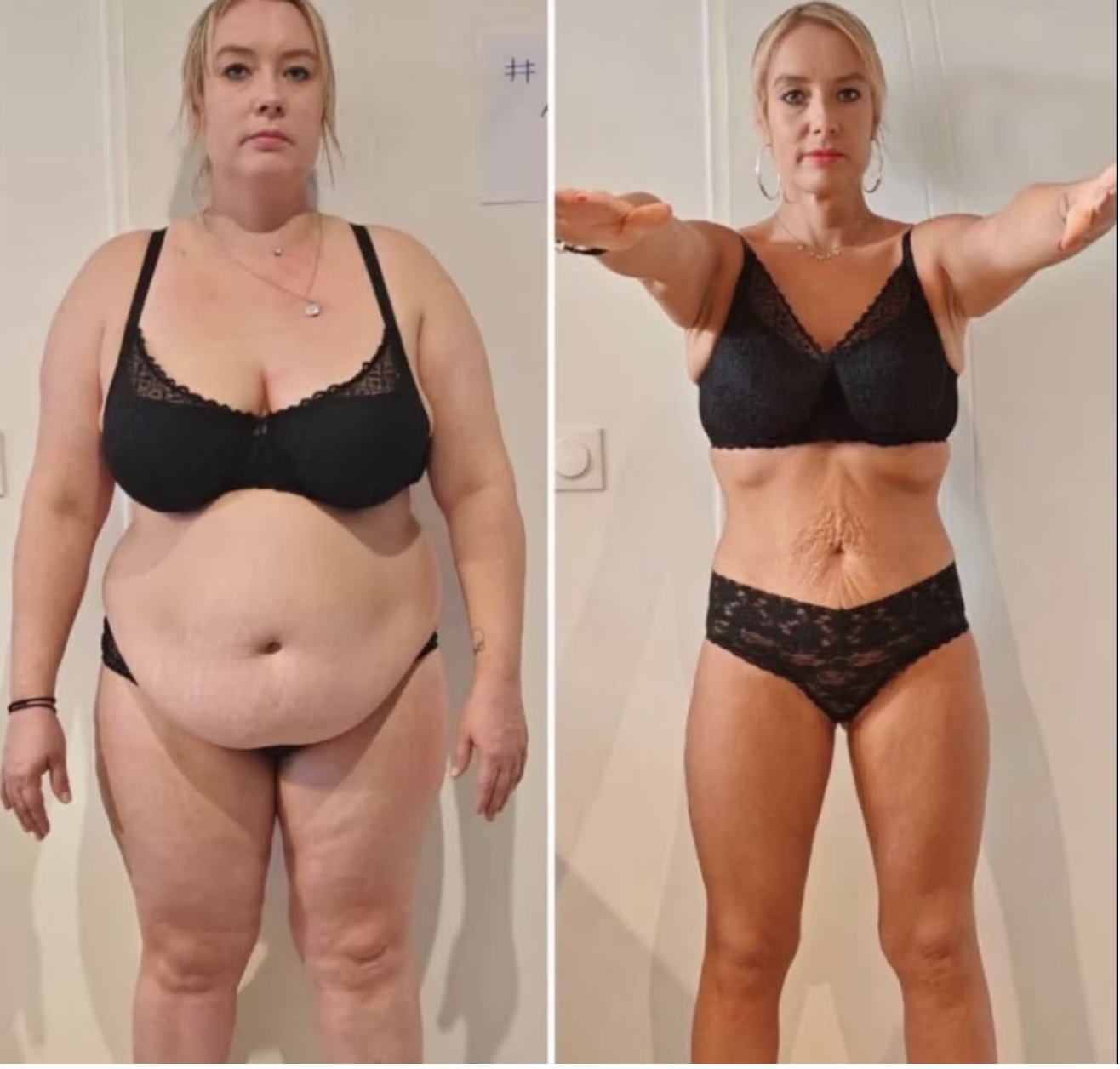 Transformation avant après